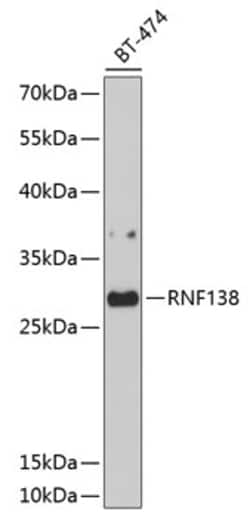 Invitrogen RNF138 Polyclonal Antibody 100 &mu;L; Unconjugated:Antibodies,