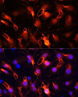 Invitrogen RNF149 Polyclonal Antibody 100 &mu;L; Unconjugated:Antibodies,