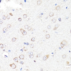 Invitrogen RNF149 Polyclonal Antibody 100 &mu;L; Unconjugated:Antibodies,