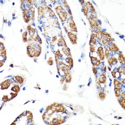 Invitrogen RNF149 Polyclonal Antibody 100 &mu;L; Unconjugated:Antibodies,