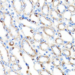 Invitrogen RNF149 Polyclonal Antibody 100 &mu;L; Unconjugated:Antibodies,