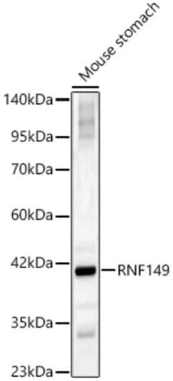 Invitrogen RNF149 Polyclonal Antibody 100 &mu;L; Unconjugated:Antibodies,