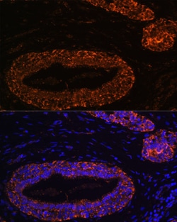 Invitrogen RNF31 Polyclonal Antibody 100 &mu;L; Unconjugated:Antibodies,
