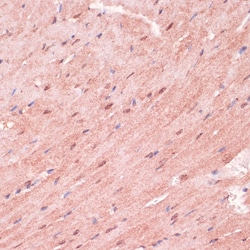 Invitrogen RNF5 Polyclonal Antibody 100 &mu;L; Unconjugated:Antibodies,