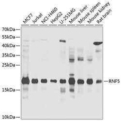 Invitrogen RNF5 Polyclonal Antibody 100 &mu;L; Unconjugated:Antibodies,