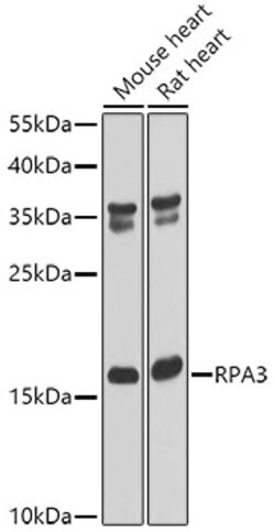 Invitrogen RPA14 Polyclonal Antibody 100 &mu;L; Unconjugated:Antibodies,