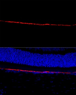 Invitrogen RPE65 Polyclonal Antibody 100 &mu;L; Unconjugated:Antibodies,