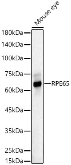 Invitrogen RPE65 Polyclonal Antibody 100 &mu;L; Unconjugated:Antibodies,