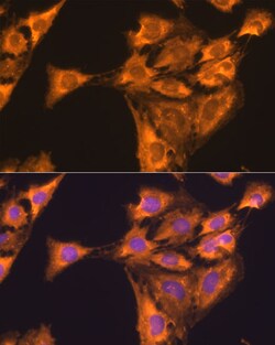 Invitrogen RPL23 Polyclonal Antibody 100 μL; Unconjugated:Antibodies,