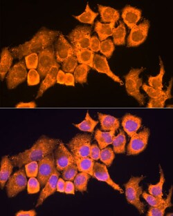 Invitrogen RPL23 Polyclonal Antibody 100 μL; Unconjugated:Antibodies,
