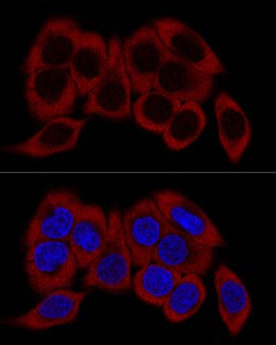 Invitrogen RPL23 Polyclonal Antibody 100 μL; Unconjugated:Antibodies,