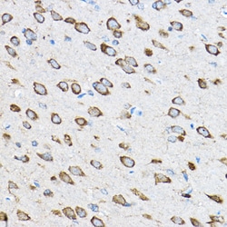 Invitrogen RPL23 Polyclonal Antibody 100 μL; Unconjugated:Antibodies,
