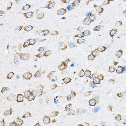 Invitrogen RPL23 Polyclonal Antibody 100 μL; Unconjugated:Antibodies,