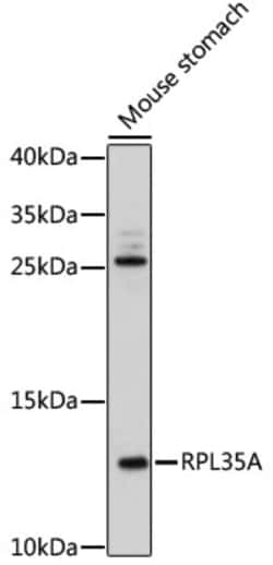 Invitrogen RPL35A Polyclonal Antibody 100 μL; Unconjugated:Antibodies,