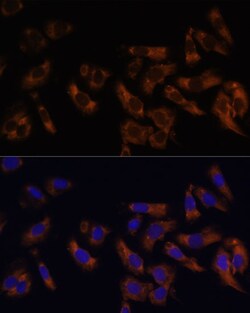 Invitrogen RPL36AL Polyclonal Antibody 100 &mu;L; Unconjugated:Antibodies,