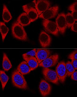 Invitrogen RPL36AL Polyclonal Antibody 100 &mu;L; Unconjugated:Antibodies,