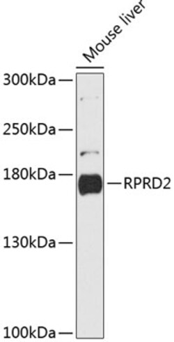 Invitrogen RPRD2 Polyclonal Antibody 100 &mu;L; Unconjugated:Antibodies,