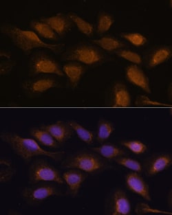 Invitrogen RSK3 Polyclonal Antibody 100 &mu;L; Unconjugated:Antibodies,
