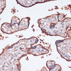 Invitrogen RSK3 Polyclonal Antibody 100 &mu;L; Unconjugated:Antibodies,