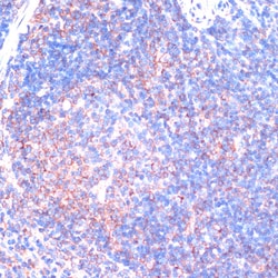 Invitrogen RSK3 Polyclonal Antibody 100 &mu;L; Unconjugated:Antibodies,