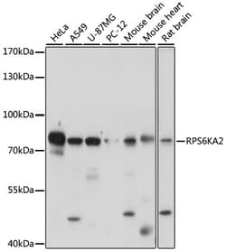 Invitrogen RSK3 Polyclonal Antibody 100 &mu;L; Unconjugated:Antibodies,
