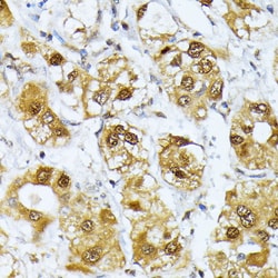 Invitrogen RRAGD Polyclonal Antibody 100 μL; Unconjugated:Antibodies,