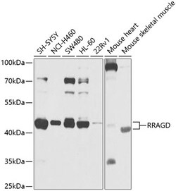 Invitrogen RRAGD Polyclonal Antibody 100 μL; Unconjugated:Antibodies,