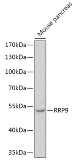 Invitrogen RRP9 Polyclonal Antibody 100 &mu;L; Unconjugated:Antibodies,