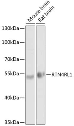 Invitrogen RTN4RL1 Polyclonal Antibody 100 μL; Unconjugated:Antibodies,