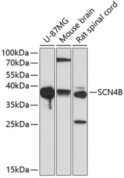 Invitrogen SCN4B Polyclonal Antibody 100 &mu;L; Unconjugated:Antibodies,