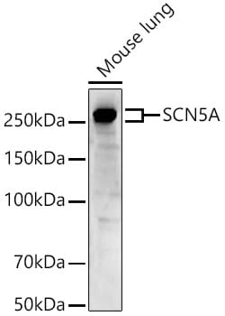 Invitrogen SCN5A Polyclonal Antibody 100 &mu;L; Unconjugated:Antibodies,