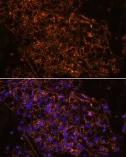 SCNN1G Polyclonal Antibody:Antibodies, Polyclonal