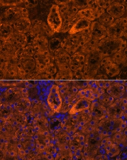 SCNN1G Polyclonal Antibody:Antibodies, Polyclonal