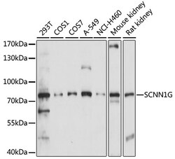 SCNN1G Polyclonal Antibody:Antibodies, Polyclonal