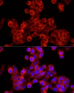 Invitrogen SEC24C Polyclonal Antibody 100 &mu;L; Unconjugated:Antibodies,