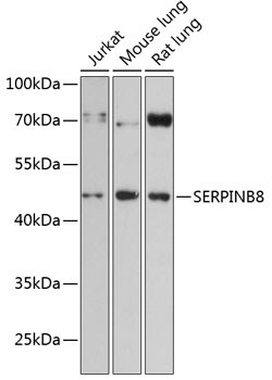Invitrogen SERPINB8 Polyclonal Antibody 100 &mu;L; Unconjugated:Antibodies,