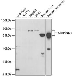 Invitrogen Heparin Cofactor II Polyclonal Antibody 100 μL; Unconjugated:Antibodies,