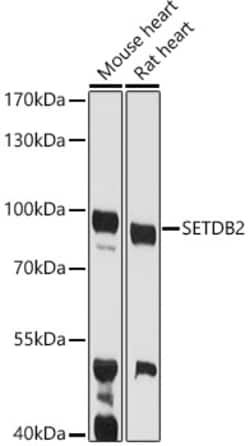 Invitrogen SETDB2 Polyclonal Antibody 100 &mu;L; Unconjugated:Antibodies,