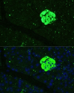 Invitrogen SFRP5 Polyclonal Antibody 100 &mu;L; Unconjugated:Antibodies,