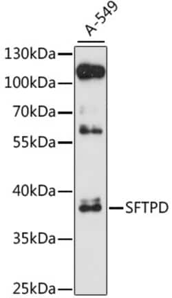 Invitrogen SFTPD Polyclonal Antibody 100 &mu;L | Buy Online | Invitrogen&trade; | Fisher Scientific