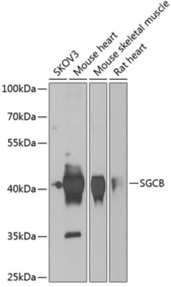 Invitrogen SGCB Polyclonal Antibody 100 &mu;L; Unconjugated:Antibodies,