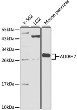 Invitrogen ALKBH7 Polyclonal Antibody 100 &mu;L; Unconjugated:Antibodies,