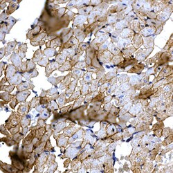 Invitrogen SLC14A1 Polyclonal Antibody 100 &mu;L; Unconjugated:Antibodies,
