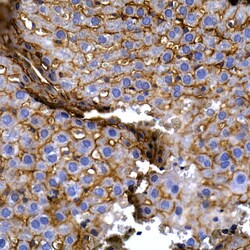 Invitrogen SLC14A1 Polyclonal Antibody 100 &mu;L; Unconjugated:Antibodies,
