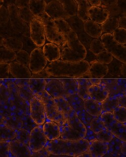 Invitrogen SLC14A1 Polyclonal Antibody 100 &mu;L; Unconjugated:Antibodies,