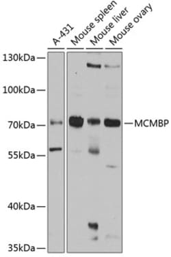 Invitrogen MCMBP Polyclonal Antibody 100 &mu;L; Unconjugated:Antibodies,