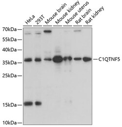 Invitrogen CTRP5 Polyclonal Antibody 100 &mu;L; Unconjugated:Antibodies,