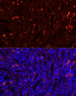 Invitrogen SLC4A1 Polyclonal Antibody 100 &mu;L; Unconjugated:Antibodies,