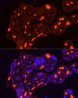 Invitrogen SLC4A1 Polyclonal Antibody 100 &mu;L; Unconjugated:Antibodies,