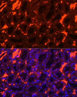Invitrogen SLC4A1 Polyclonal Antibody 100 &mu;L; Unconjugated:Antibodies,